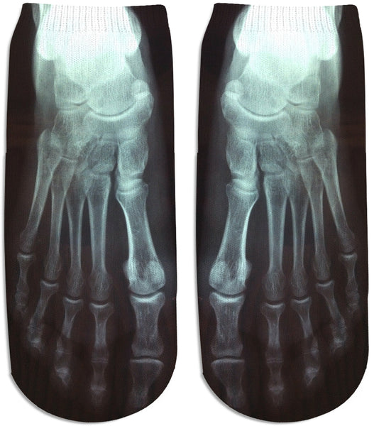 X-Ray Ankle Socks