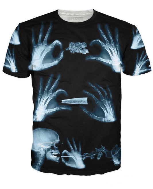 X-Ray T-Shirt